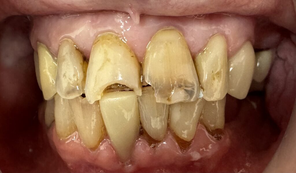 Before smile success story 5