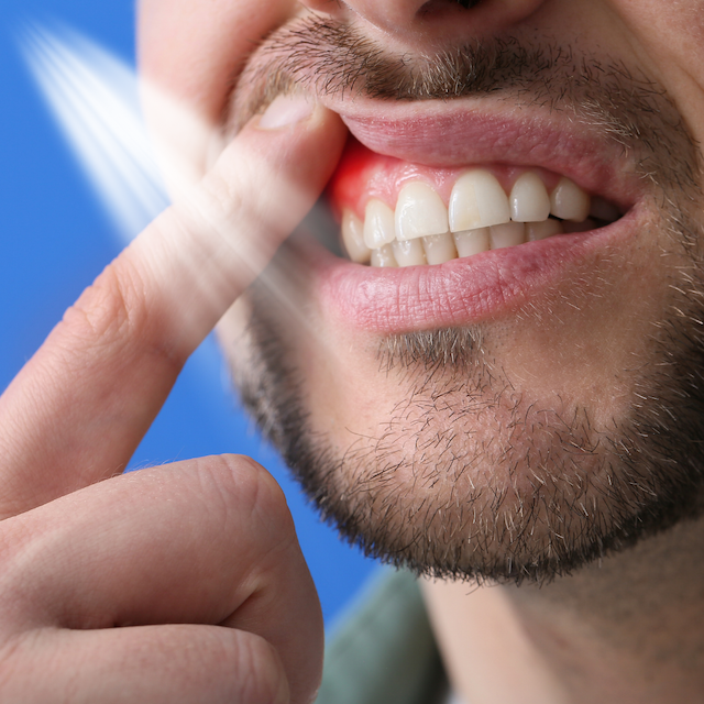 periodontal care | gummy smile | oral health