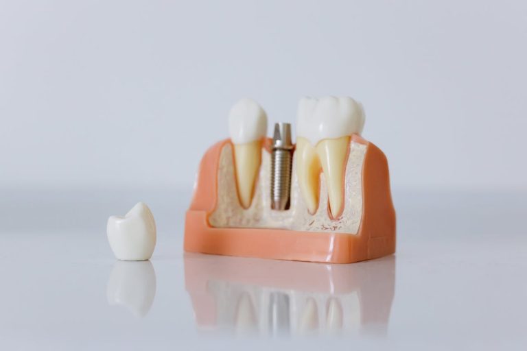 replace tooth